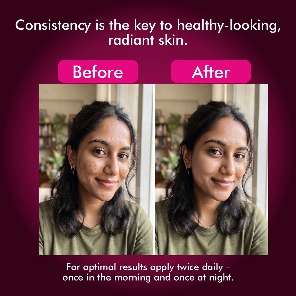 CLEAN BEAUTY FACE SERUM (10% NIACINAMIDE )