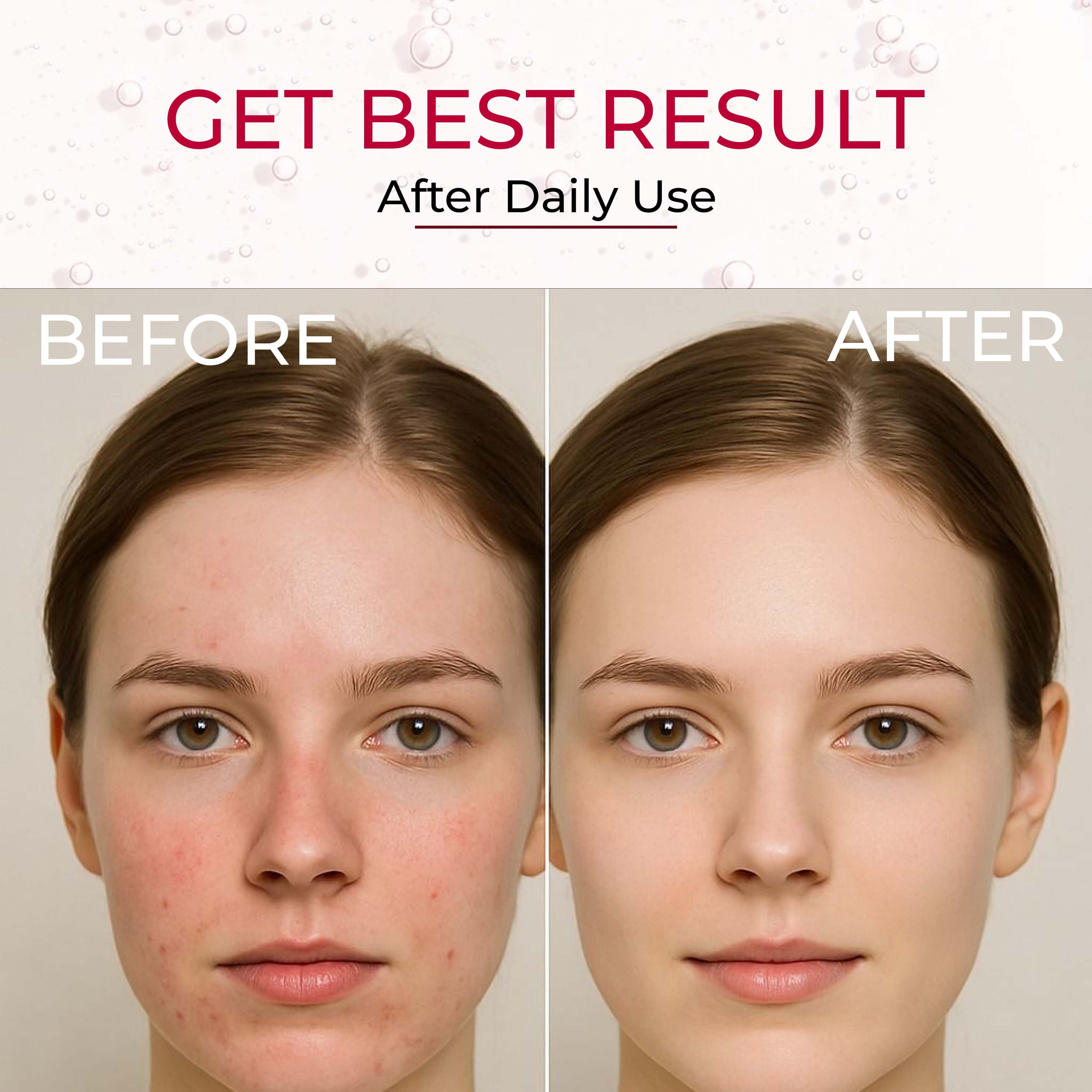 CLEAN BEAUTY FACE SERUM (10% NIACINAMIDE )
